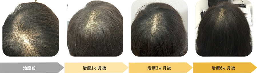 治療症例1 イメージ写真