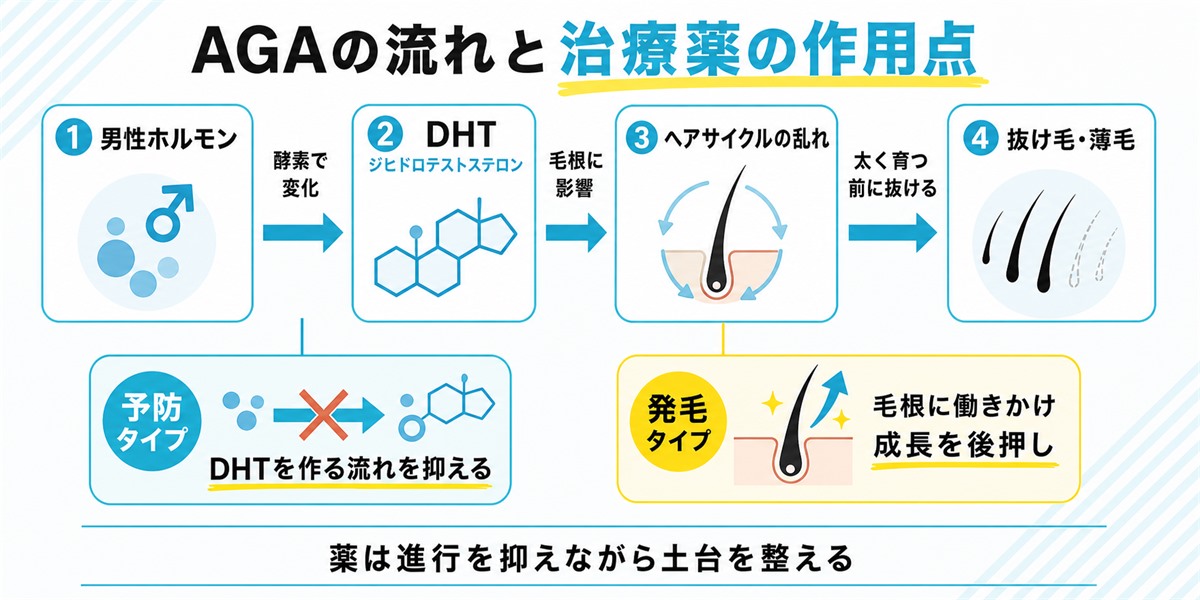 AGAで男性ホルモンからできるDHTがヘアサイクルを乱して抜け毛を招く流れと予防薬がDHTを抑え発毛薬が毛根に働きかける作用点を示した仕組み図