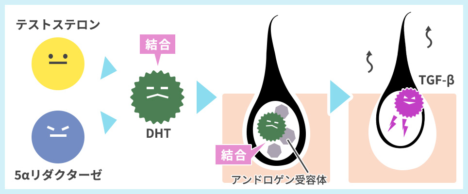 AGA・FAGAが起こる仕組みの図説