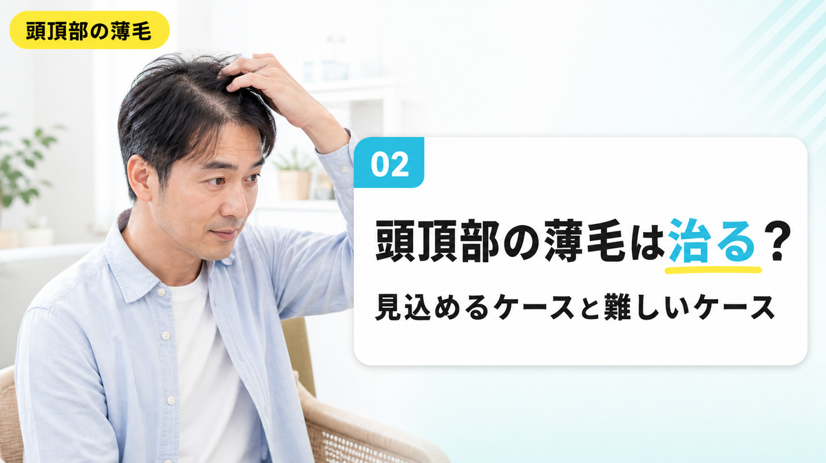 頭頂部の薄毛は治るのか改善が見込めるケースと難しいケースを切り分ける見出しイメージ