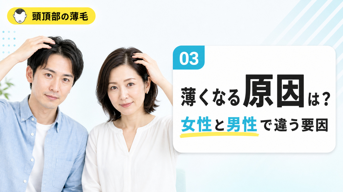 頭頂部が薄くなる原因は女性と男性で違う要因があることを示す見出しイメージ