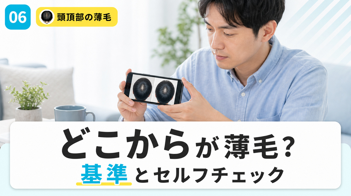 頭頂部の薄毛はどこからかという基準とセルフチェックの見分け方を解説する見出しイメージ