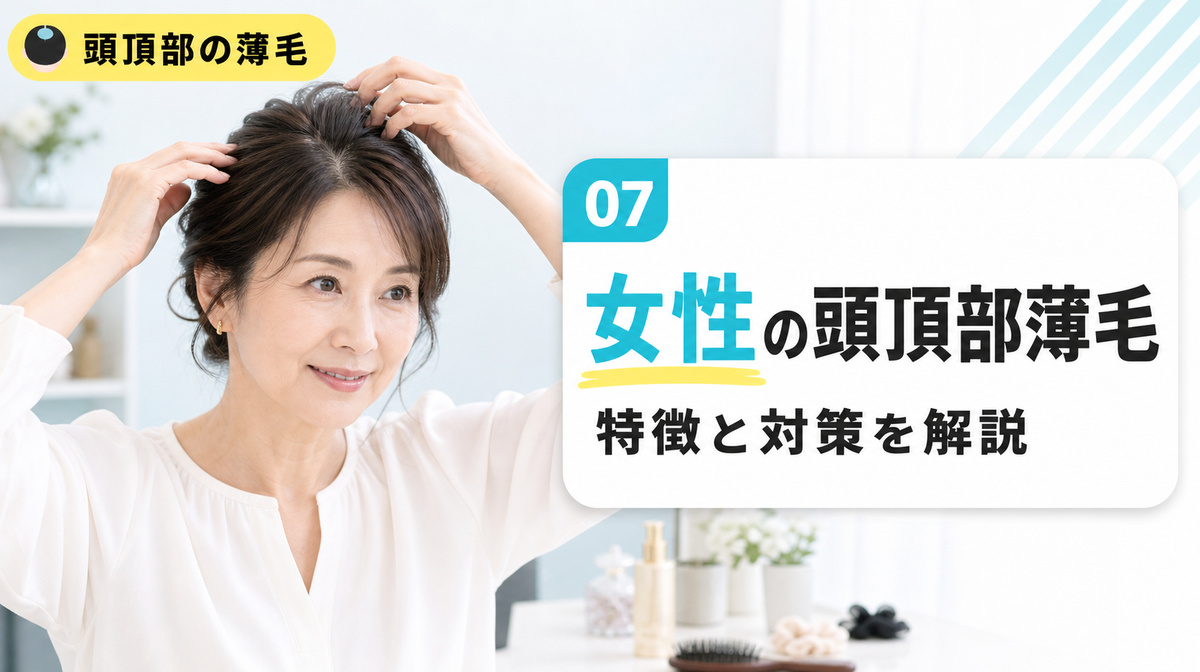 女性の頭頂部薄毛の特徴と対策を年代別に解説する見出しイメージ