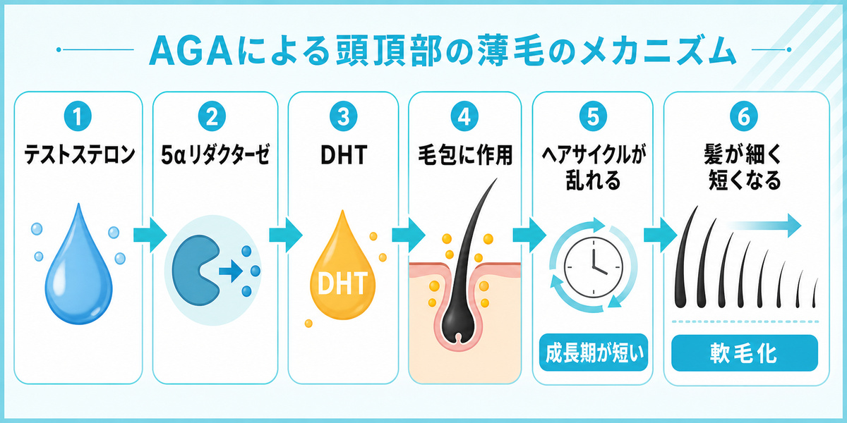 テストステロンが5αリダクターゼでDHTに変わりヘアサイクルが乱れて髪が細くなるAGAの仕組みを示した図