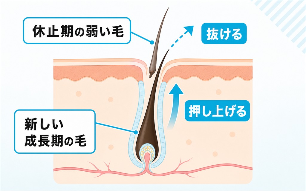 休止期の弱い毛が新しい成長期の毛に押し出されて抜ける初期脱毛の仕組みを示した図