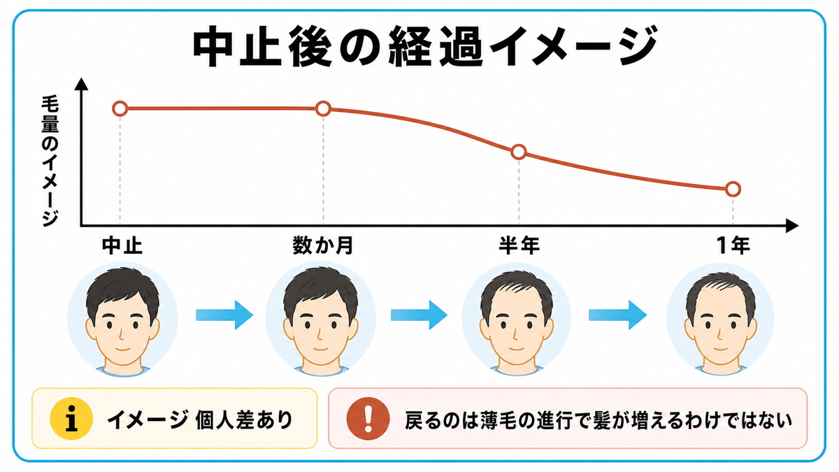 フィナステリドの中止後に数か月から1年かけて薄毛の進行が服用前へ戻っていく経過のイメージを示した図解