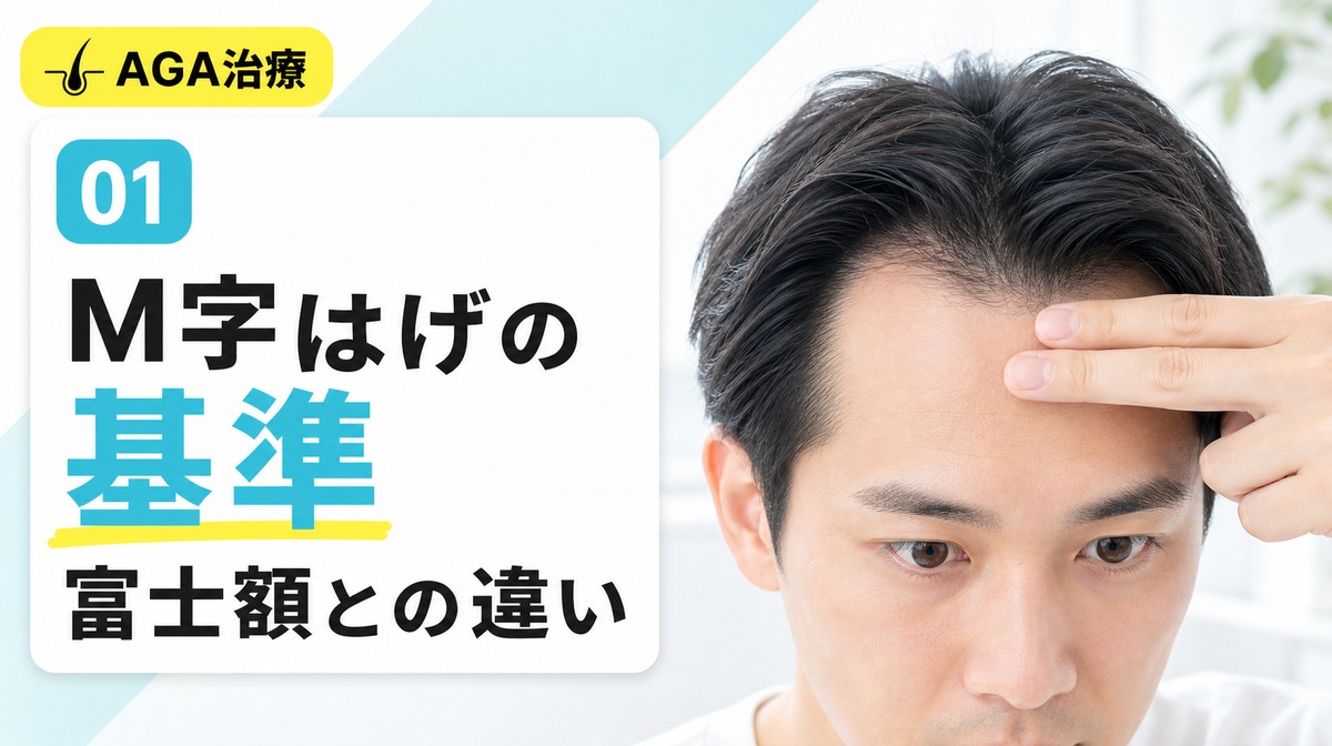 M字はげの基準と生まれつきの富士額との違いを解説する見出しイメージ