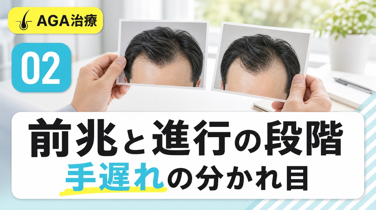M字はげの前兆から手遅れまでの進行段階とノーウッド分類を解説する見出しイメージ