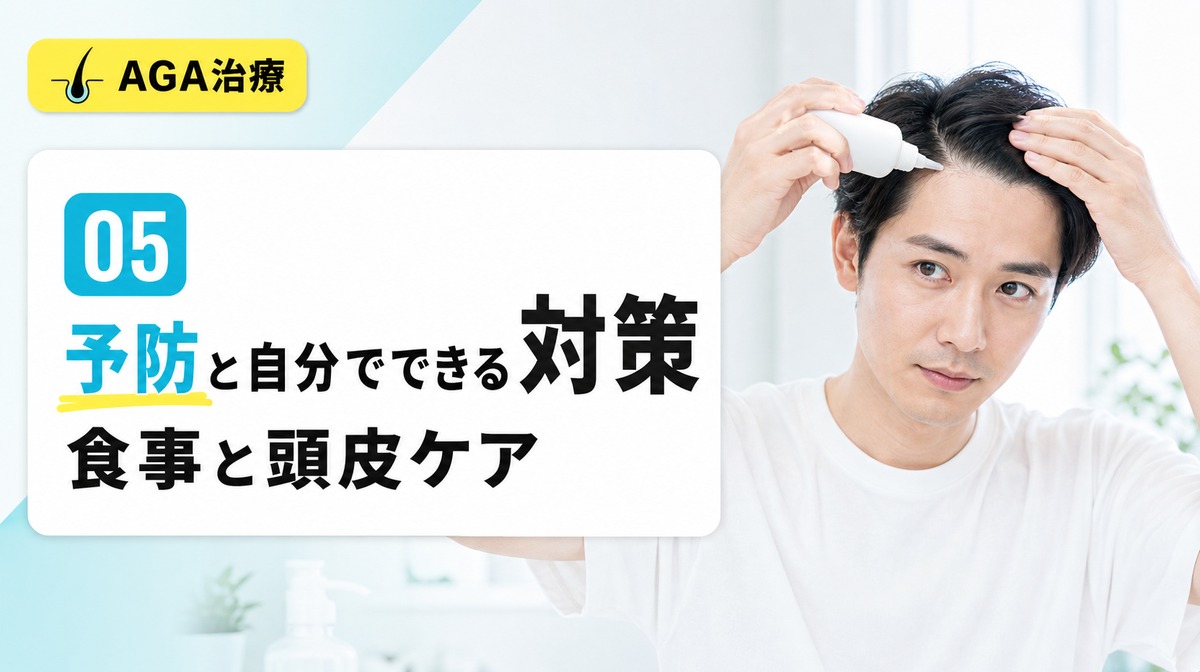 M字はげの予防に役立つ食事や頭皮マッサージとシャンプーの見直しを解説する見出しイメージ