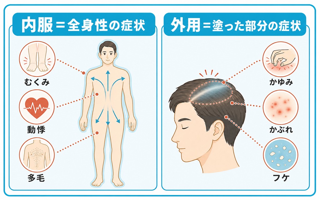 内服で起こりやすいむくみや動悸などの全身性の症状と、外用で起こりやすいかゆみなど塗った部分の症状を人体図で対比した図