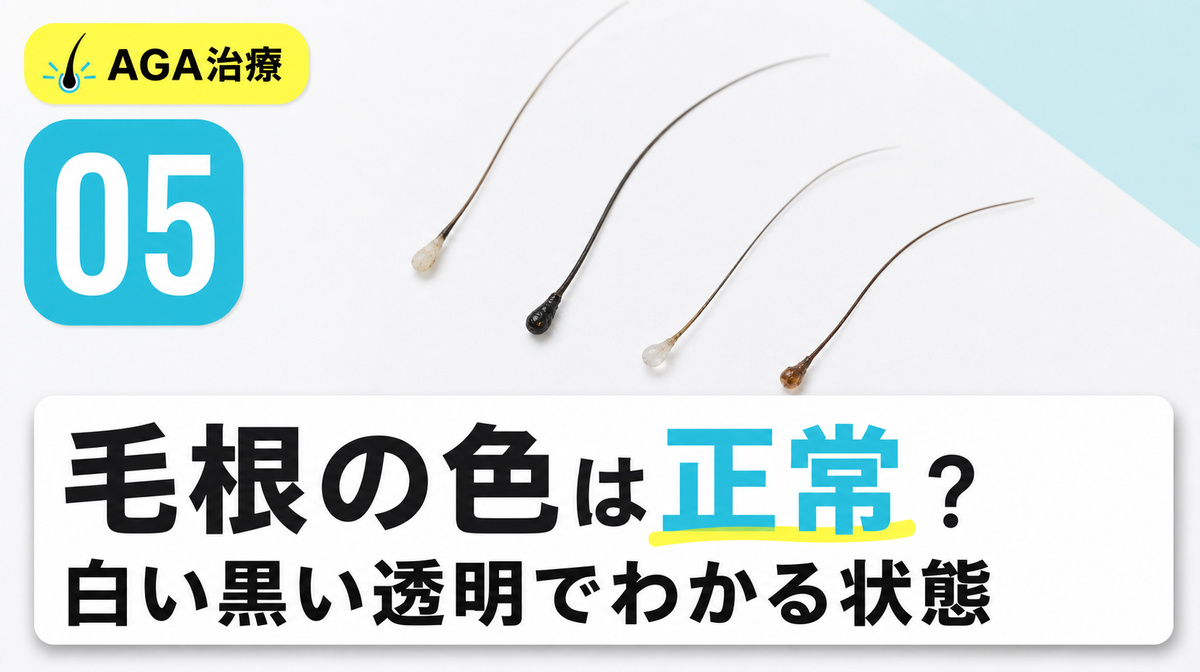 毛根が白い黒い透明など色でわかる頭皮の状態を解説する見出しイメージ