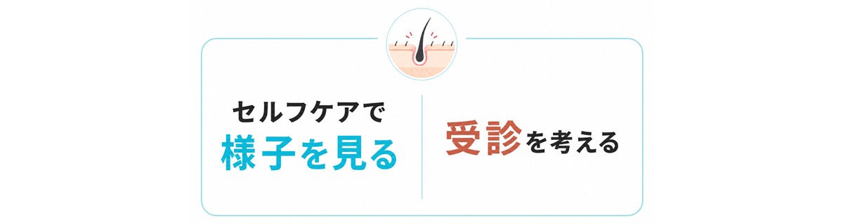 頭皮ニキビをセルフケアで様子を見る場合と受診を考える場合の境目を示したキャッチ図