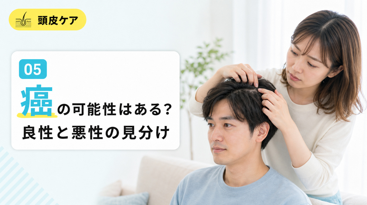 頭皮のできものが癌の可能性があるかと良性と悪性の見分けを確かめる見出しイメージ
