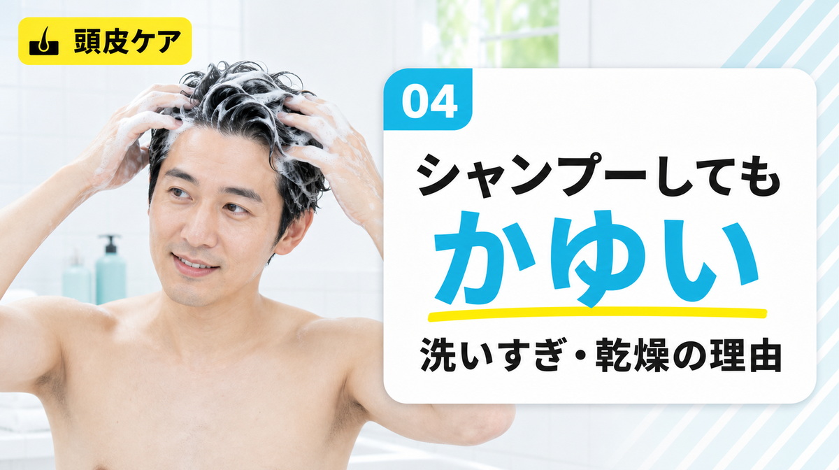 シャンプーしても頭皮がかゆい理由を洗いすぎや乾燥の落とし穴から解説する見出しイメージ