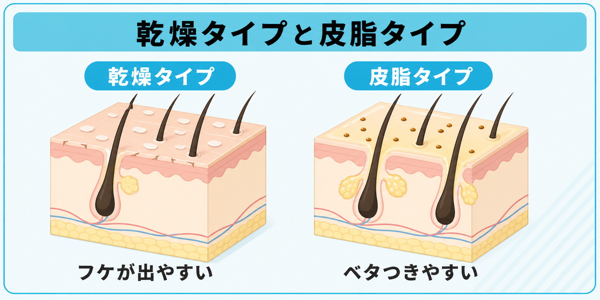 乾燥タイプと皮脂タイプの頭皮断面の違いを皮脂量やバリア機能とともに対比したイラスト図