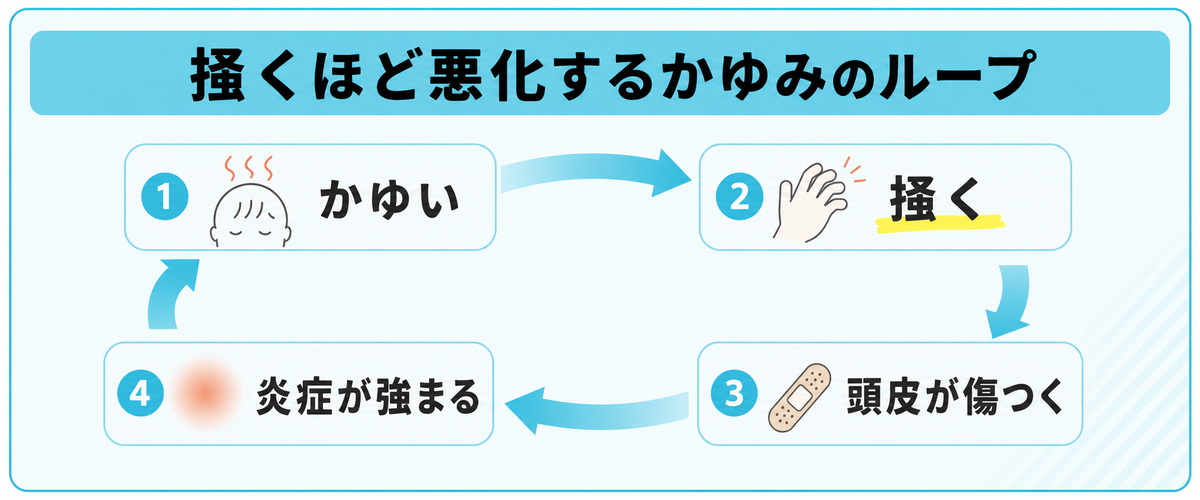 かゆみから掻く・頭皮が傷つく・炎症が強まりさらにかゆくなる掻く悪化のループを示した図