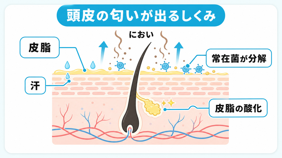 頭皮の毛穴から出た皮脂が酸化し常在菌に分解されて匂いの成分が立ちのぼるしくみを示した頭皮の断面概念図