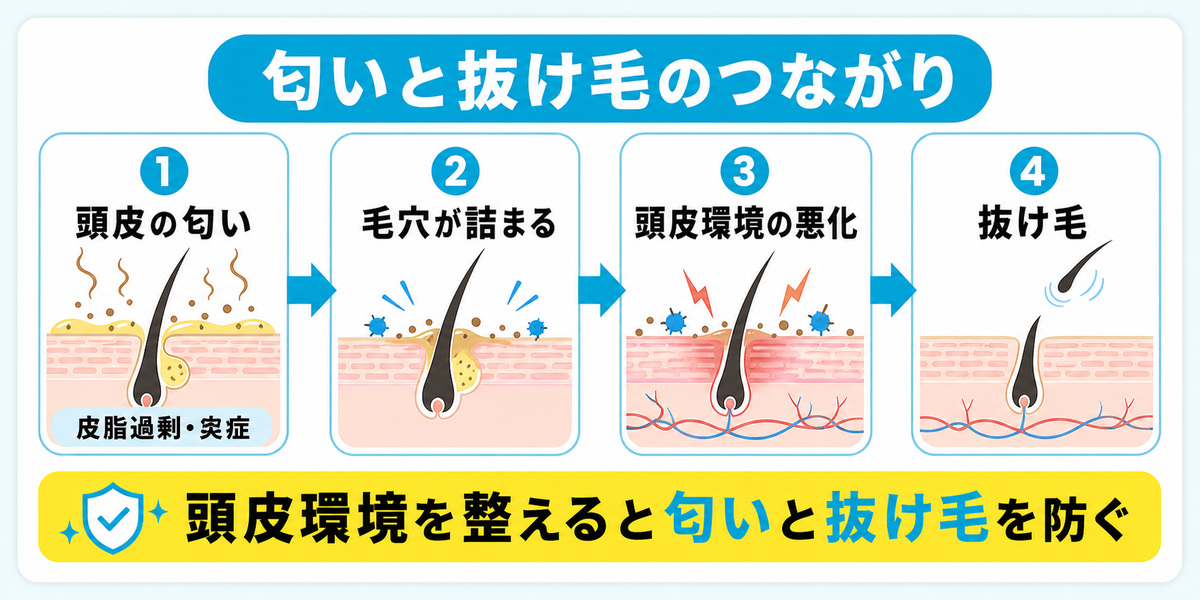 頭皮の匂いの背景にある皮脂過剰や炎症が毛穴詰まりと頭皮環境の悪化を招き抜け毛につながる流れを示した因果図