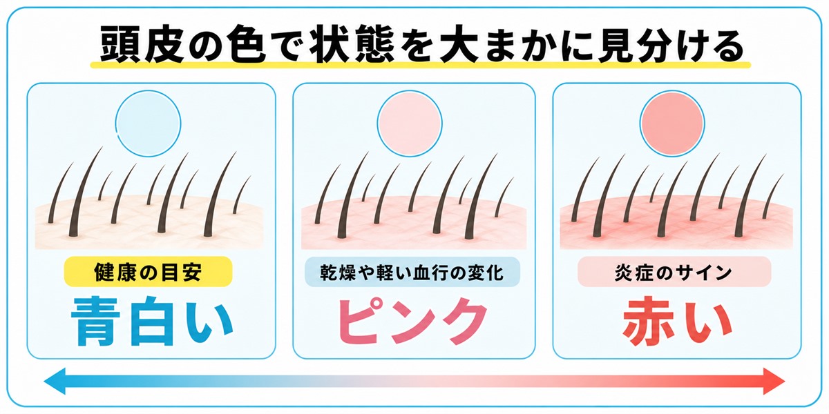 青白い頭皮とピンク色や赤い頭皮の色の違いを健康な状態と乾燥・炎症とともに対比したイラスト図