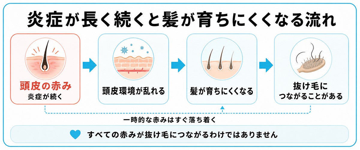 頭皮の赤み(炎症)が続くと頭皮環境が乱れ髪が育ちにくくなり抜け毛につながる関係を示したフロー図