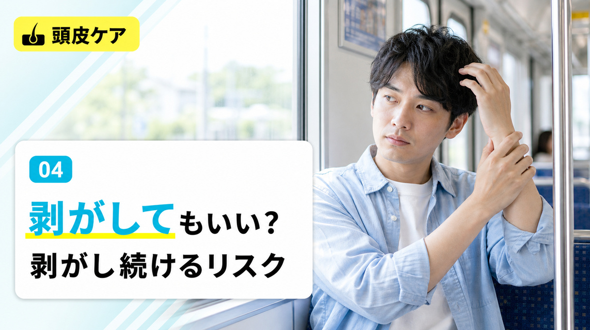 頭皮のかさぶたは剥がしてもいいかや剥がし続けるリスクを解説する見出しイメージ