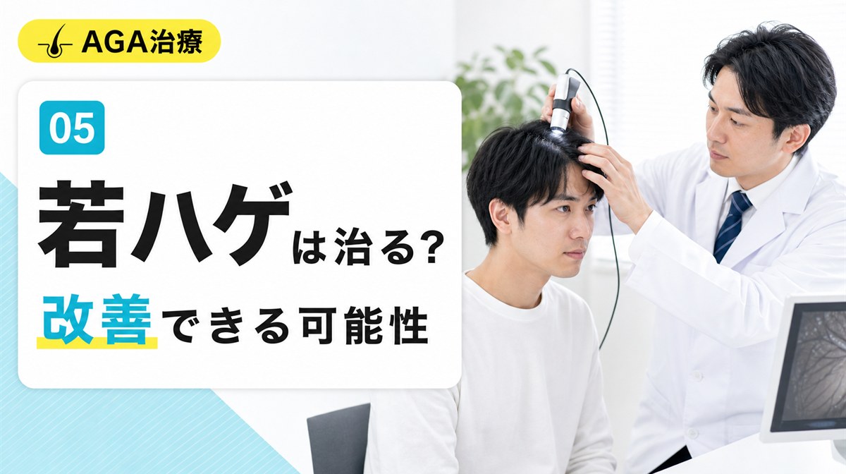 若ハゲは改善できるのかという疑問と改善の可能性や進行段階別にできることを解説する見出しイメージ