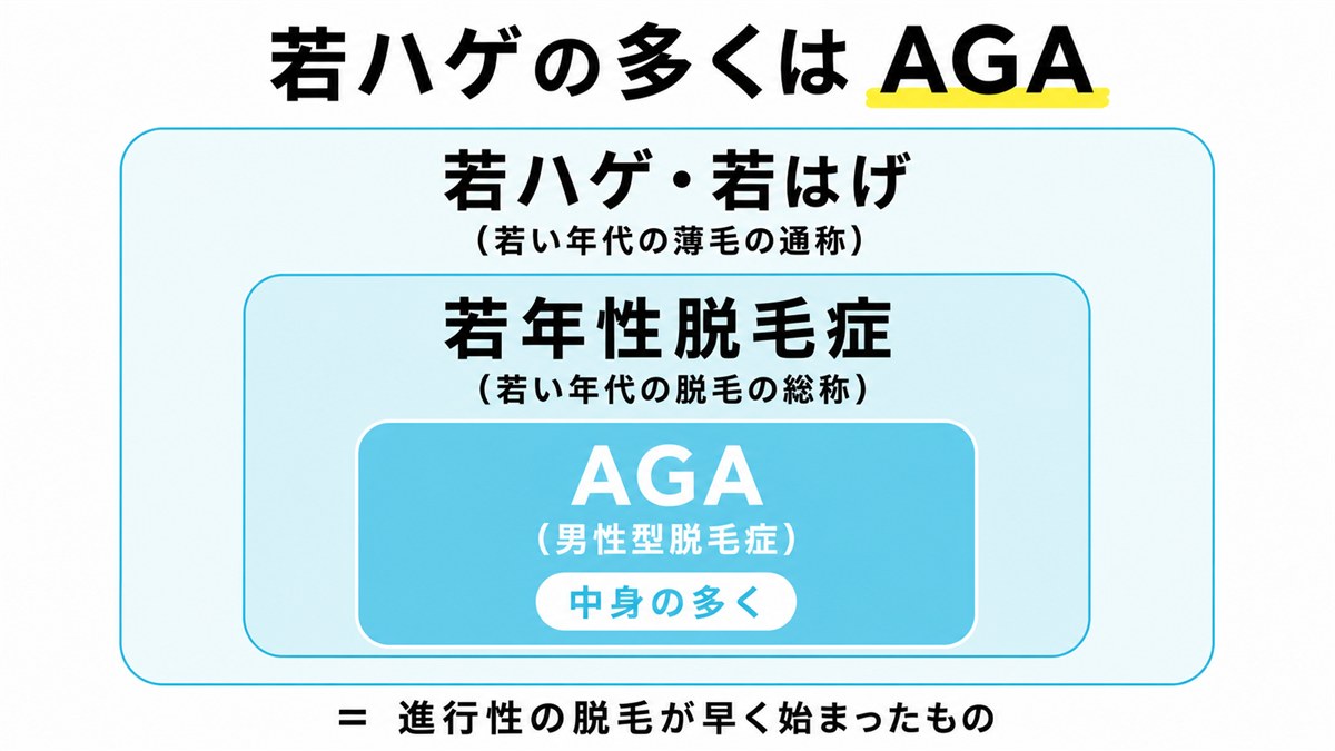 若ハゲの多くが若年性脱毛症やAGAにあたる包含関係を示す図解