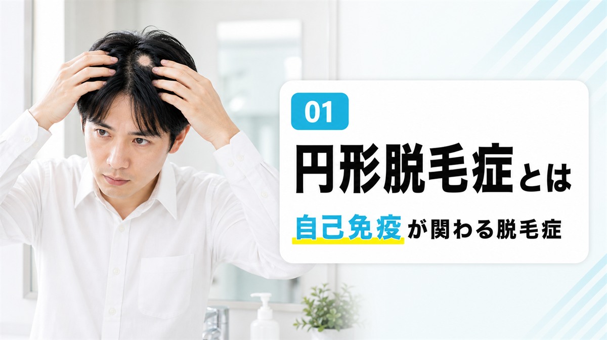 円形脱毛症とは何かと自己免疫の関わりを確かめる見出しイメージ