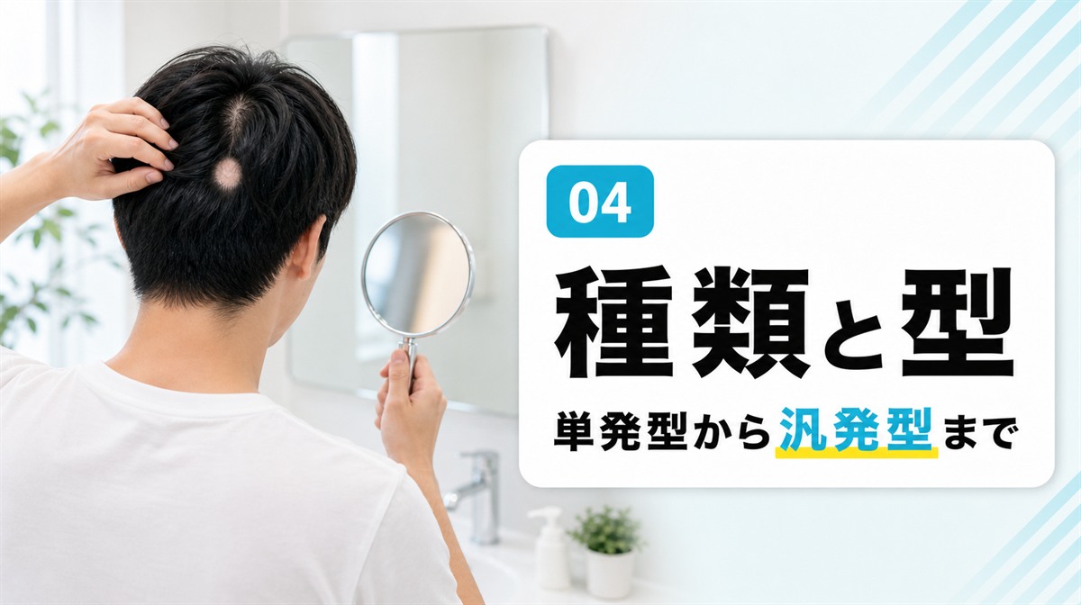 円形脱毛症の種類と型を単発型から汎発型まで紹介する見出しイメージ