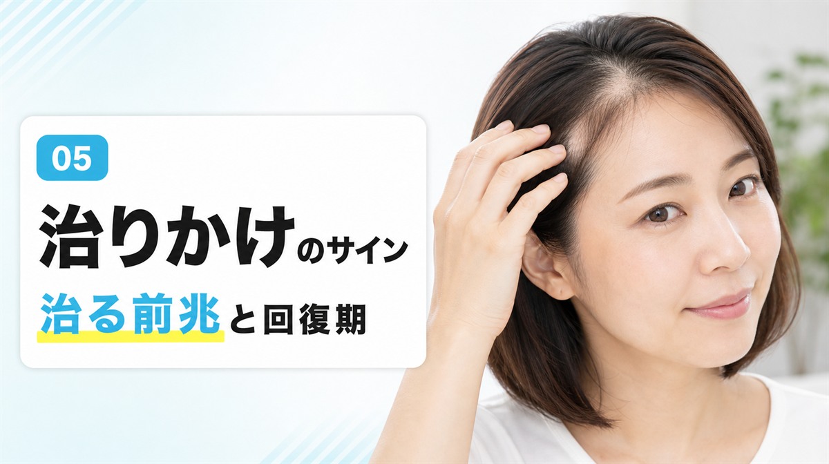円形脱毛症の治りかけのサインや治る前兆と回復期を解説する見出しイメージ